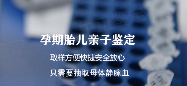 太原孕期亲子鉴定如何办理,太原孕期亲子鉴定机构在哪有 太原孕期亲子鉴定如何办理,太原孕期亲子鉴定机构在哪有